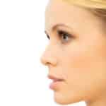 rhinoplasty_stock_1