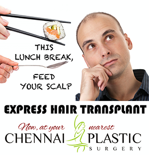 Express Hair Transplant 1 Blog