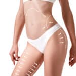 Lipo Page