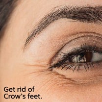 Crows-Feet-Blog-Visual_Blog Crows Feet Blog Visual Blog
