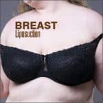 Breast Lipo 01