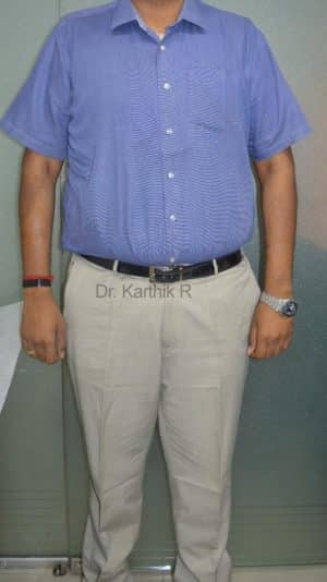 Weight Loss Program