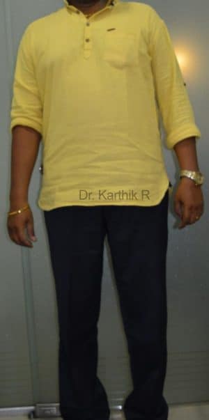 Weight Loss Program