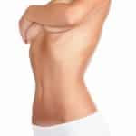 Tummy Tuck Stock 2