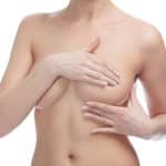 Tuberous Breast 1