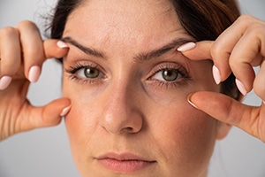 Is Blepharoplasty Right For Me? 1 Close-Up Portrait Of Caucasian Middle-Aged Woman Showing Expression Lines Around Eyes. Signs Of Aging On The Face.