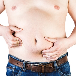 What Is Tumescent Liposuction Like? 1 Excess Body Weight Of A Man With His Hands Touching Fat On His Stomach