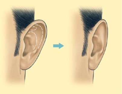 Happy New Ear 2 Ba Ear1